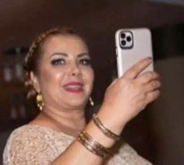 Balık etli Tanyeli'nin eski halinden eser yok! Tam 40 kilo birden verdi: Yolda gören tanıyamayacak! 6